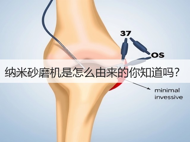 纳米砂磨机是怎么由来的你知道吗?(图2) 纳米砂磨机是怎么由来的你知道吗?(图2)