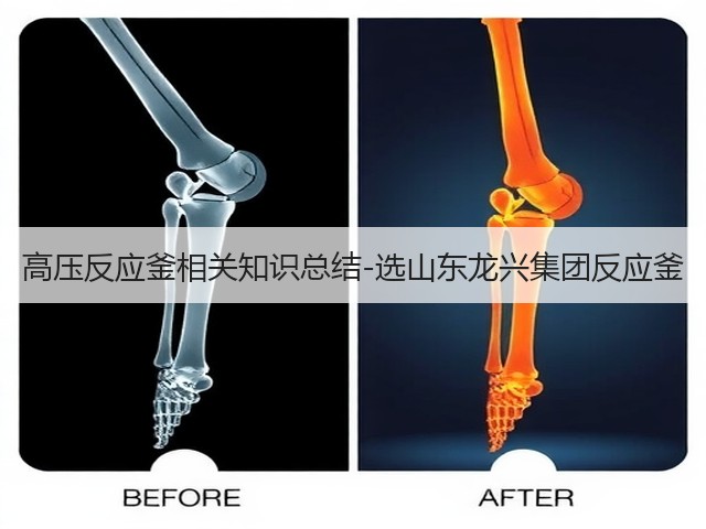 高压反应釜相关知识总结-选山东龙兴集团反应釜(图2)